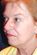 Facelift Patient 85820 Photo 1