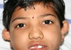 Otoplasty Patient 65190 Photo 1